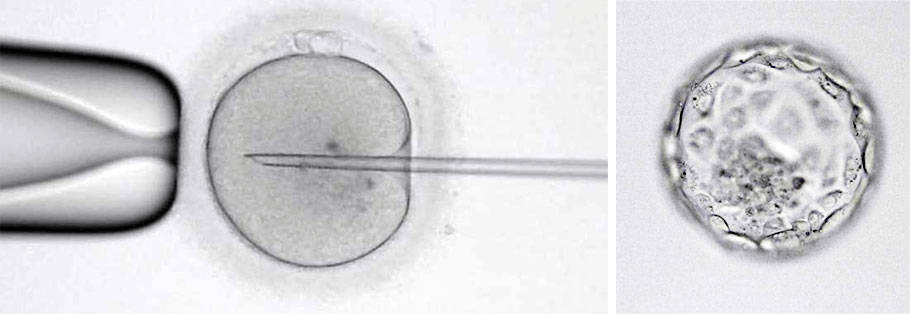 Eizelle wird künstlich befruchtet