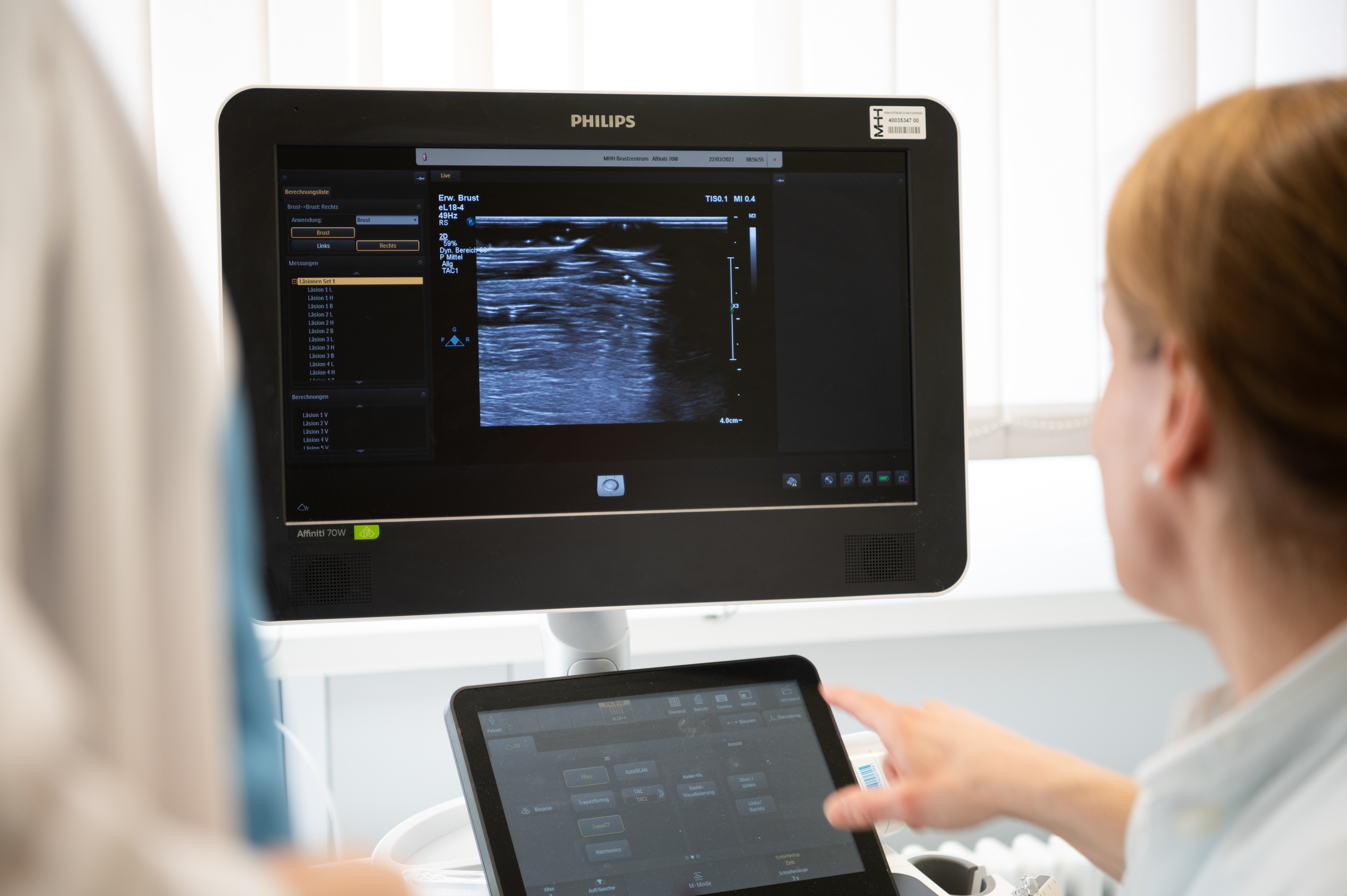 Ultraschalluntersuchung (Bildschirm)