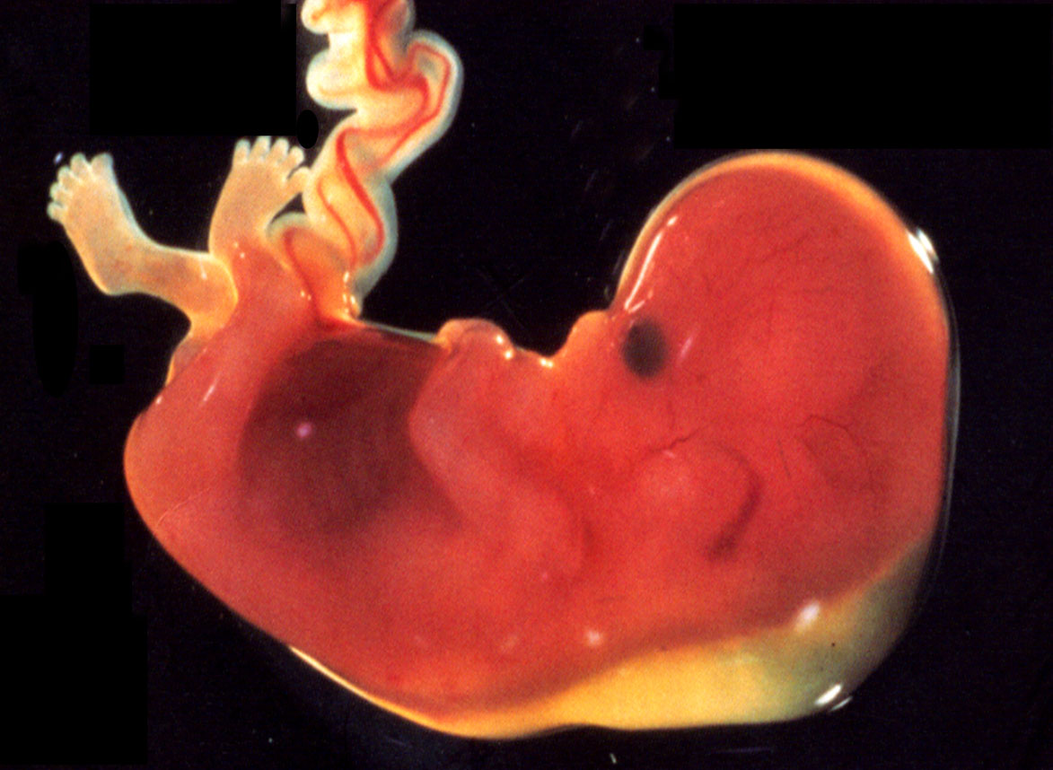 auf schwarzem Hintergrund: ein Fötus in der 12. bis 13. Schwangerschaftswoche - die Extremitäten sind bereits gut erkennbar