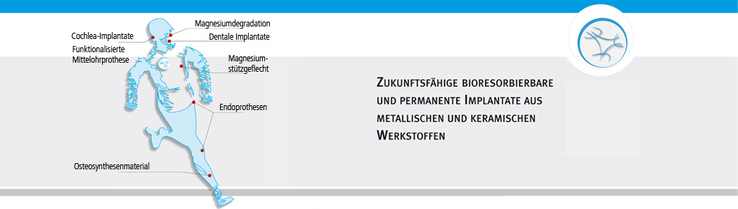 Erklärende Grafik zum Sonderforschungsbereich 599