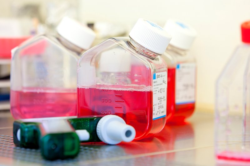 copyright K. Kaiser, MHH picture of lab equipment