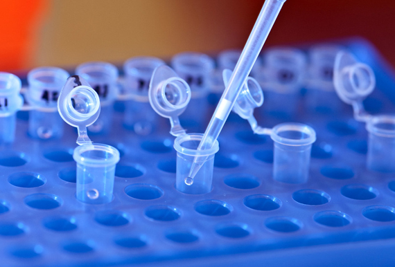 DNA lab © umseas Reaktionsgefäße mit Pipette