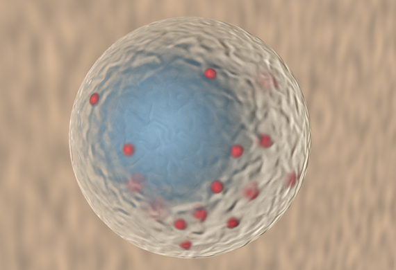 Das Bild zeigt eine gezeichnete NK-Zelle mit charakteristischen Granula, die hier rot gekennzeichnet sind. Copyright: Jacobs, Roland, KIR/MHH
