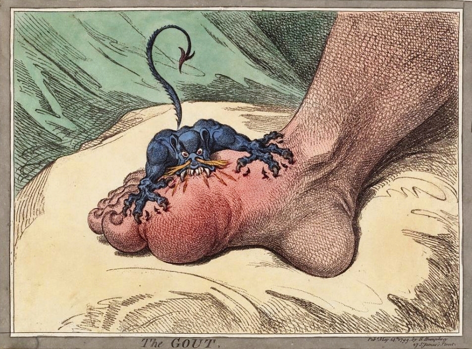 Gichtmonster