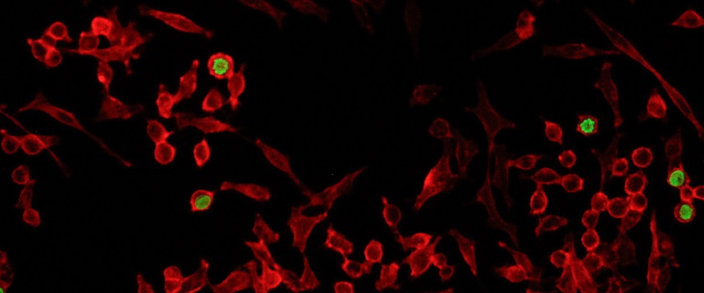 Mikroskopische Aufnahme von menschlichen Zellen in Kultur. Das Aktinskelett ist rot, der Zellkern der in Teilung befindlichen Zellen grün gefärbt.