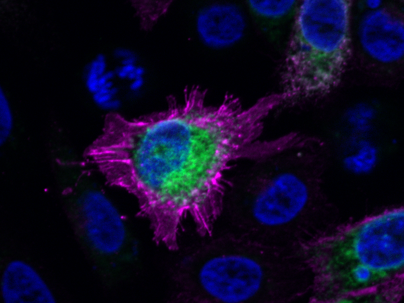 Fluoreszenz-markierte Zelle: Grün: Endoplasmatisches Retikulum Membran, Magenta: Zellmembran, blau: Zellkern. Copyright: H. Bakker - Klinische Biochemie, MHH