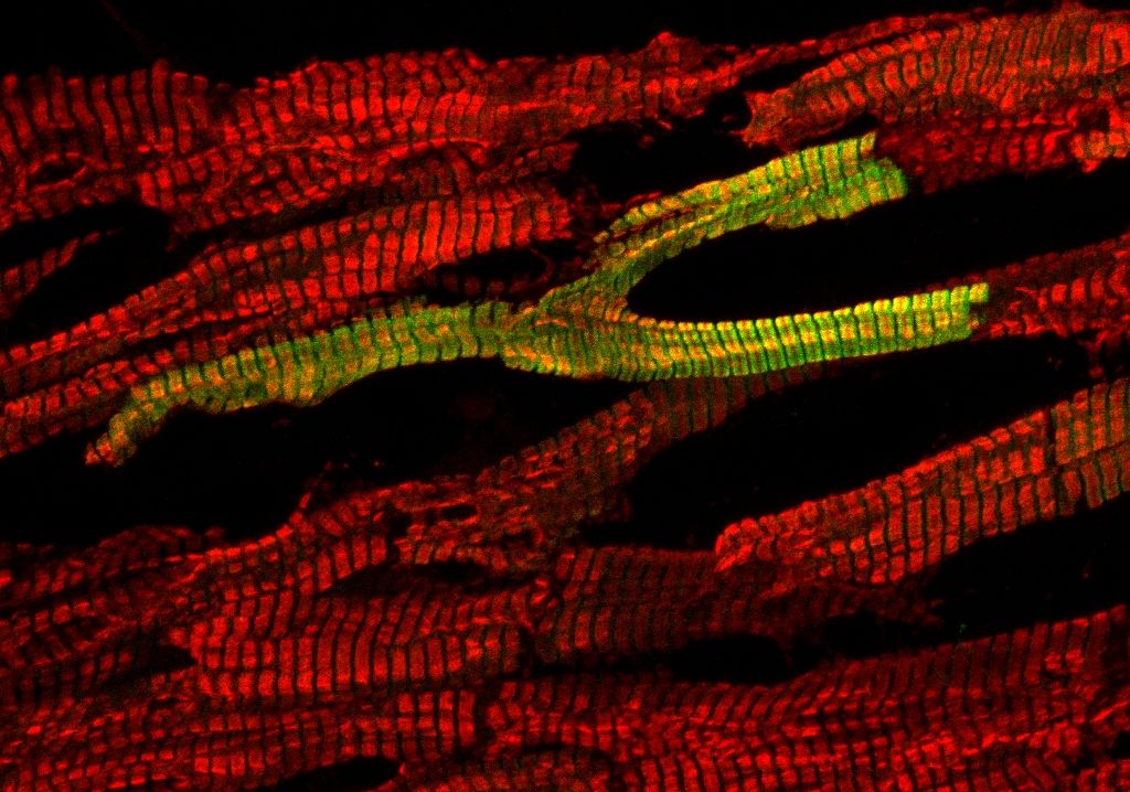 FREAK OR TEAMPLAYER? - In the human left ventricle we predominantly find cardiomyocytes which express only the slow β-myosin (red). Surprisingly, there are few cardiomyocytes, that express the fast α-myosin isoform (green) in close proximity to pure β-myosin expressing cardiomyocytes. How can such diverse cardiomyocytes functionally coexist in the myocardial network? (Finalist at the "Art of Science Image Contest of the Biophysical Society 2018"); Copyright: Holler, T. / Institut für Molekular-und Zellphysiologie / MHH