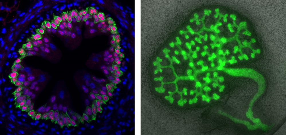 links: Immunofluoreszenzfärbung eines Paraffindünnschnittes eines adulten Harnleiters der Maus; Copyright: T. Bohnenpoll - AG Kispert, Institut für Molekularbiologie, MHH  rechts: Verzweigungsmorphogenese des sich entwickelnden Sammelrohrsystems der metanephrischen Niere der Maus; Copyright: A.-C. Weiss - AG Kispert, Institut für Molekularbiologie, MHH