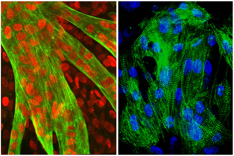 links: Immunofluoreszenz von C2C12 Skelettmuskelzellen (Copyright: R. Scheibe - Institut für Zellbiochemie, MHH);  rechts: Immunofluoreszenz von neonatalen Herzzellen der Ratte (Copyright: R. Scheibe- Institut für Zellbiochemie, MHH)