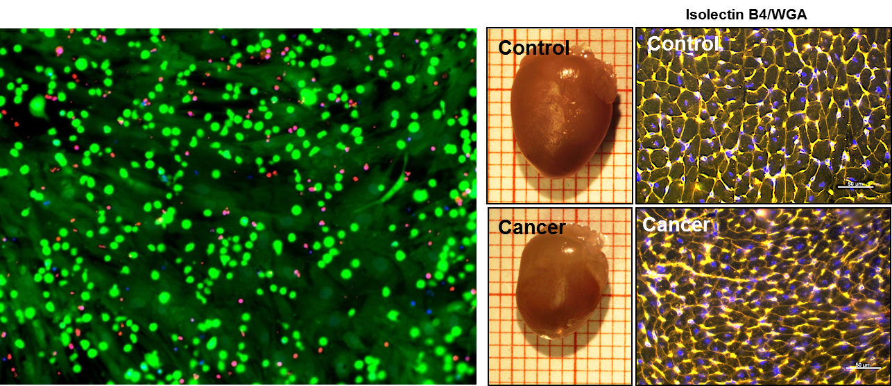 links: Fluoreszenzmikroskopische Aufnahme von hämatopoetischen Leukämiezellen. Copyright: H. Kirchhoff/Klinik für Hämatologie, Hämostaseologie, Onkologie und Stammzelltransplantation/MHH; rechts: Kardiale Atrophie ausgelöst durch eine Tumorerkrankung in Mäuseherzen (links) und in Kardiomyozyten angefärbt durch Isolectin/WGA Färbung (rechts) vom linksventrikulären Gewebe von gesunden Kontroll-Mäusen (Control) und Mäusen mit fortgeschrittener schwerer Krebserkrankung. Copyright: S. Pietzsch/Klinik für Kardiologie und Angiologie/MHH