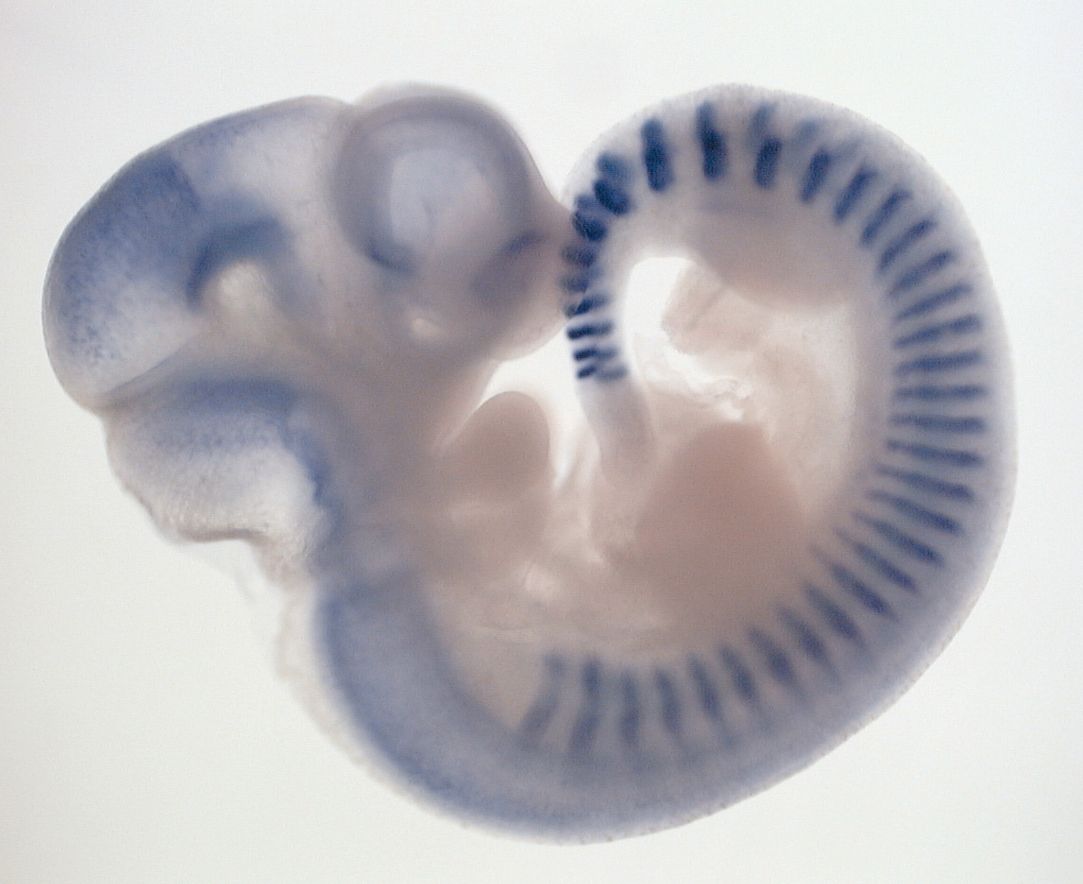 In situ Hybridisierungsanalyse der Uncx4 Expression in einem Wildtyp-Mausembryo am Embryonaltag 10,5. Die Streifen markieren die posterioren Hälften der Somiten.  Copyright: A. Kispert, Institut für Molekularbiologie, MHH