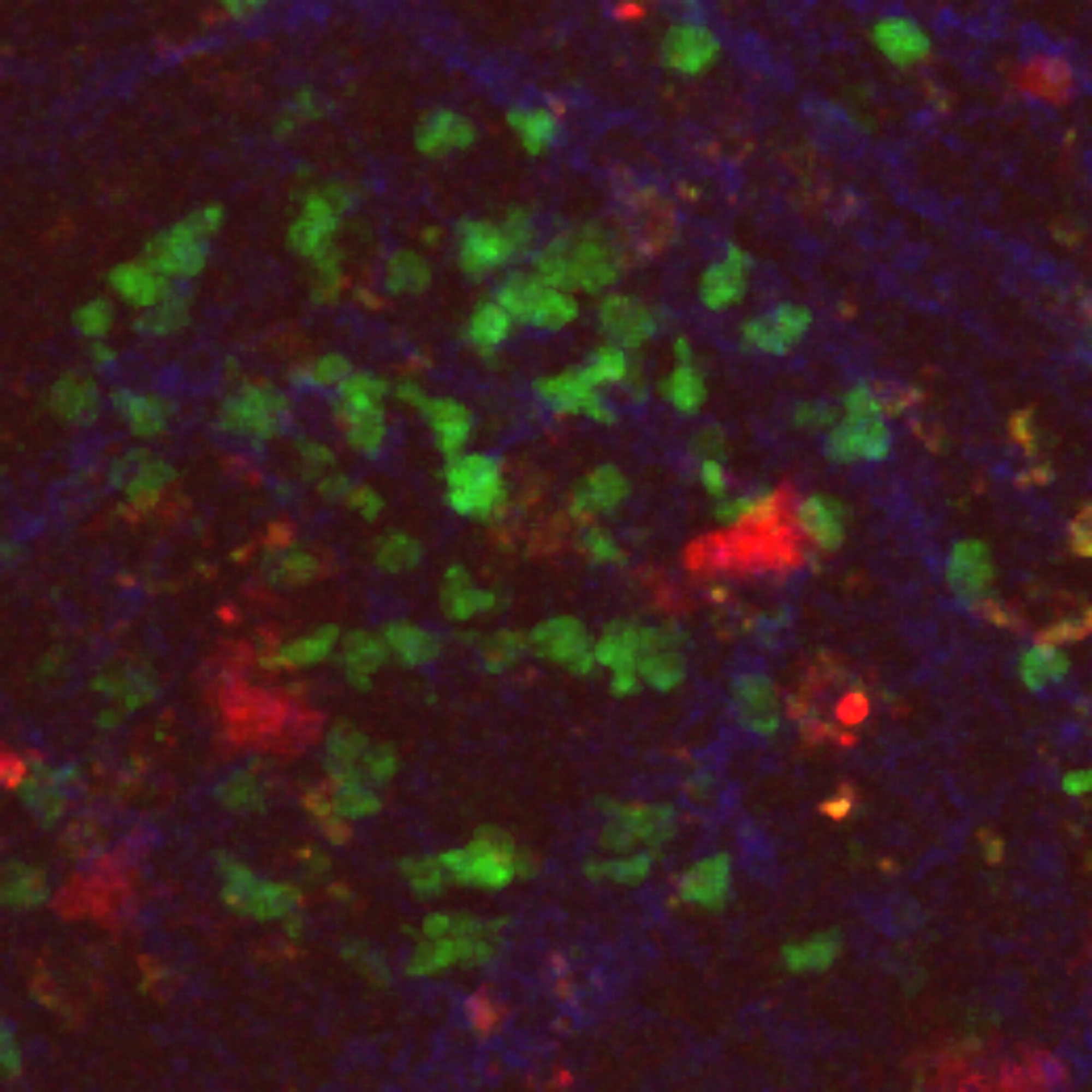 Immune cells (green) attack virus-infected cells (red) - visualized by 2-photon imaging. Copyright: S. Halle/Immunologie/MHH