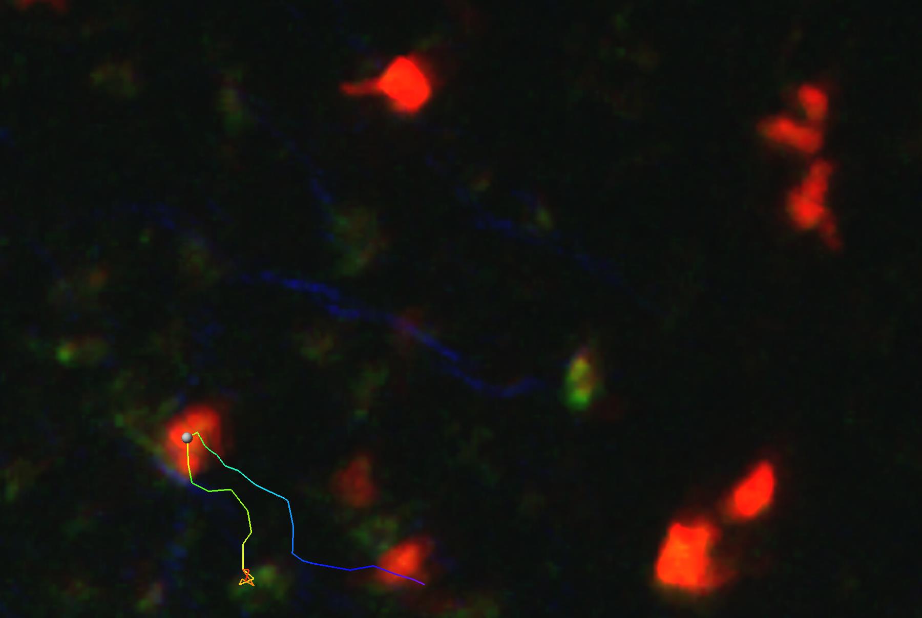 Lymphocyte migration in the lymph node (tracked immune cell). Copyright: S. Halle/Immunologie/MHH