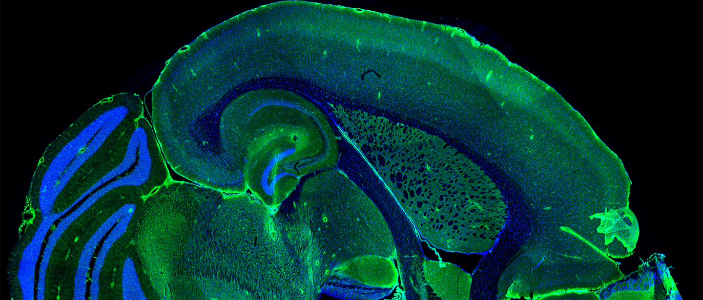 Copyright: Prof. M. Lenz/Neuroanatomie und Zellbiologie/MHH