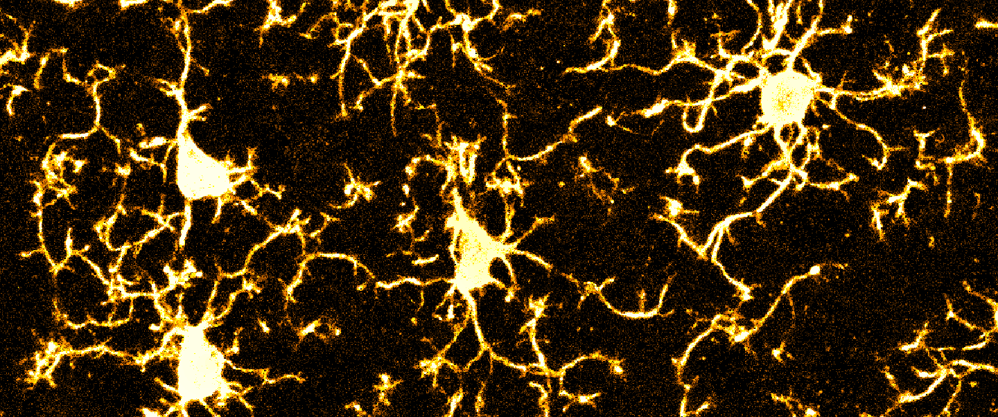 Copyright: Prof. M. Lenz/Neuroanatomie und Zellbiologie/MHH