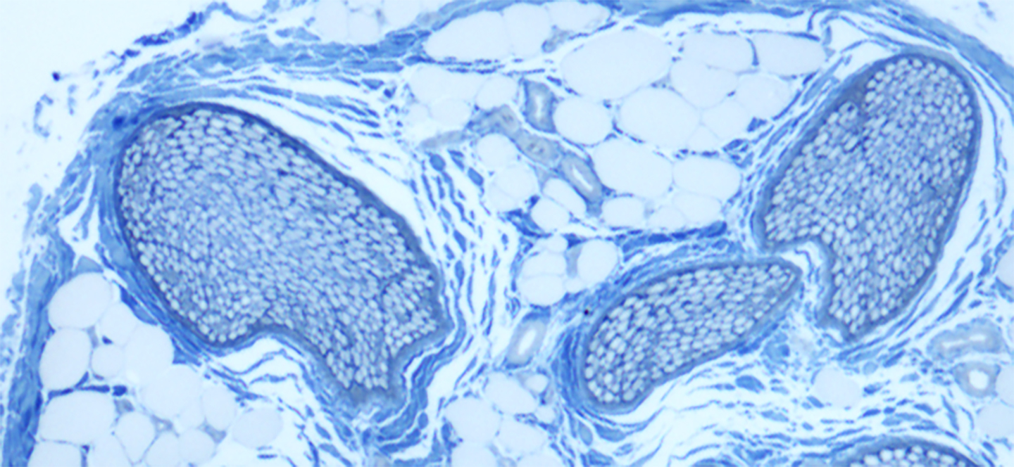 Copyright: Prof- M. Lenz/Neuroanatomie und Zellbiologie/MHH