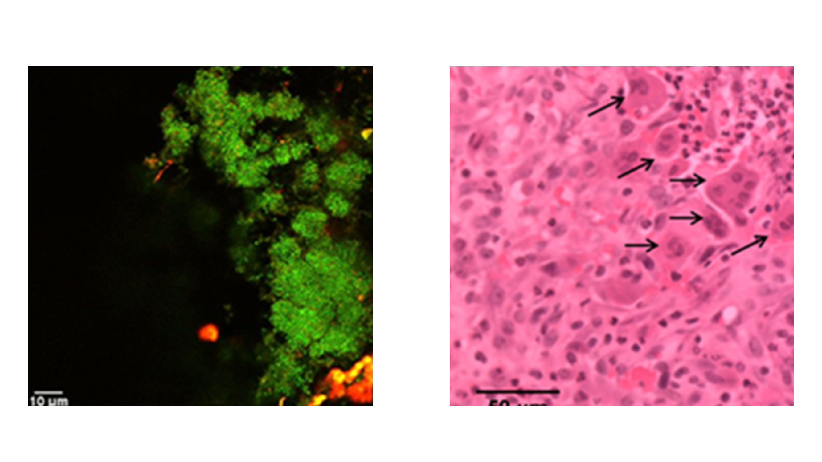 Auschnitte histologischer Schnitte, einmal Fluoreszenz gefärbt, einmal Übersichtsfärbung Hämalaun/Eosin