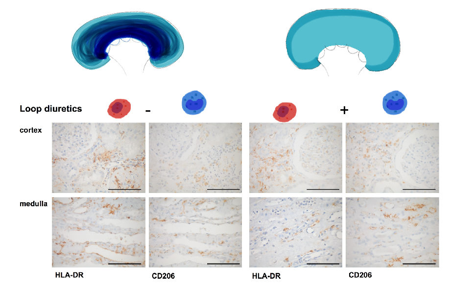 Copyright Nephrologie/MHH