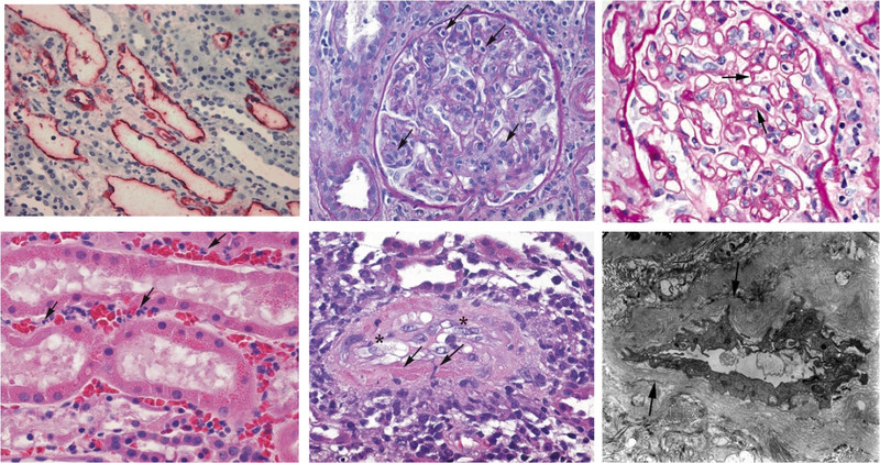 Copyright Nephrologie/MHH
