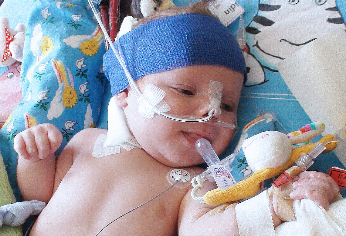 Medizinische Hochschule Hannover : ECMO & Organersatz