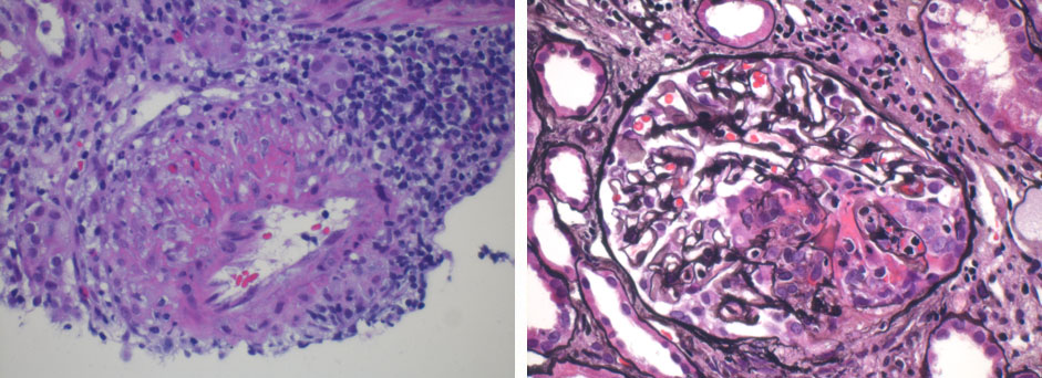 Copyright: Prof. Dr. Bräsen, MHH, Pathologie