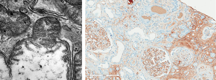 Copyright: Prof. Dr. Bräsen, MHH, Pathologie