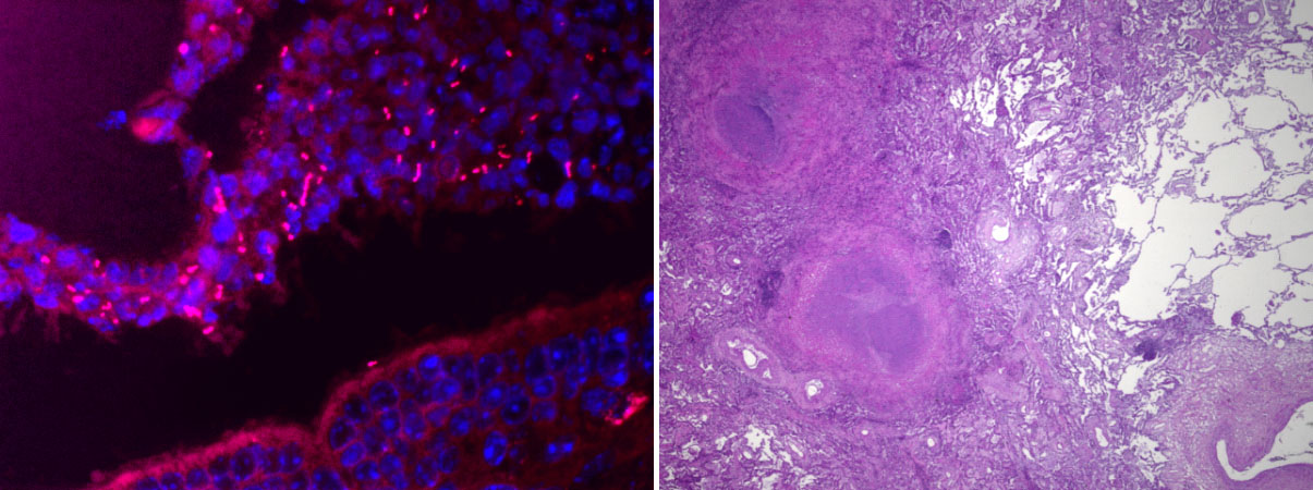 Copyright: Prof. D. Jonigk, Pathologie, MHH Copyright: Prof. D. Jonigk, Pathologie, MHH