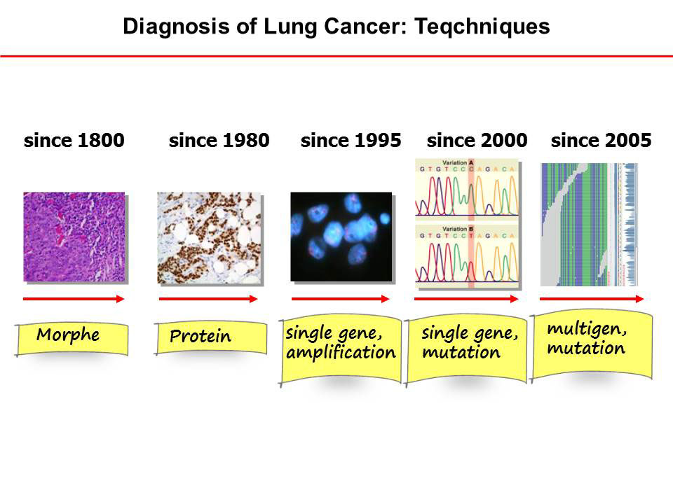 Copyright: Prof. D. Jonigk, Pathologie, MHH Copyright: Prof. D. Jonigk, Pathologie, MHH