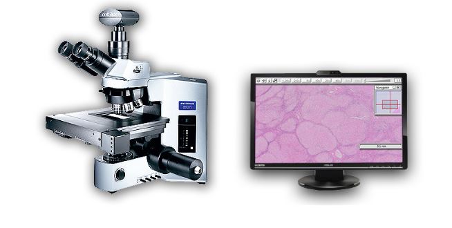 Copyright: Thomas Wildgrube, Pathologie, MHH