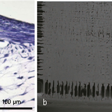 Artifizelle Haut mit Spinnenseidematrix: Abb. a HE-Färbung, Abb. b elektronenmikroskopische Aufnahme