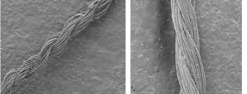 Copyright: Dr. Kathleen Henneke Nahtmaterial aus Spinnenseide im elektronenmikroskopischen Bild