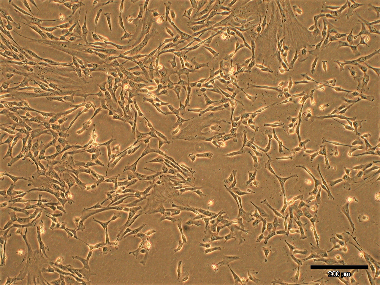 A microscopic image of the cultured human mesenchymal stem cells from the donor umbilical cord, whose stem cell products in conditioned medium were used for this therapeutic approach.