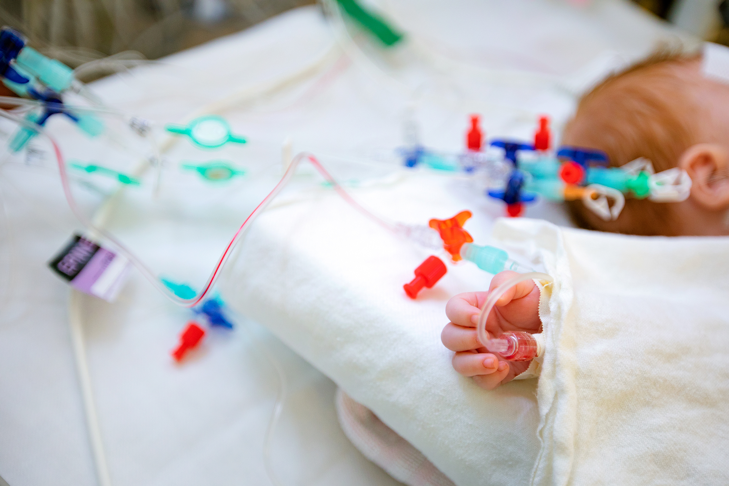 Die Hand eines Säuglings mit einem intravenösen Zugang