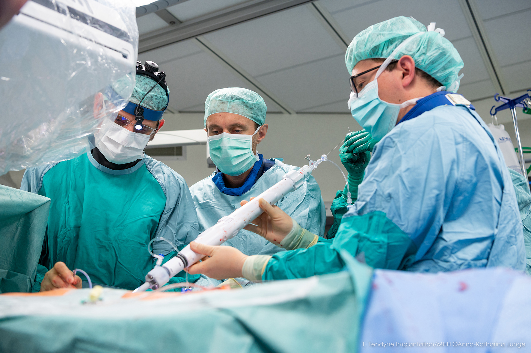 Doctors in surgical clothes stand at an intervention table and use a rod-shaped catheter system to guide the mitral valve prosthesis into a patient's heart