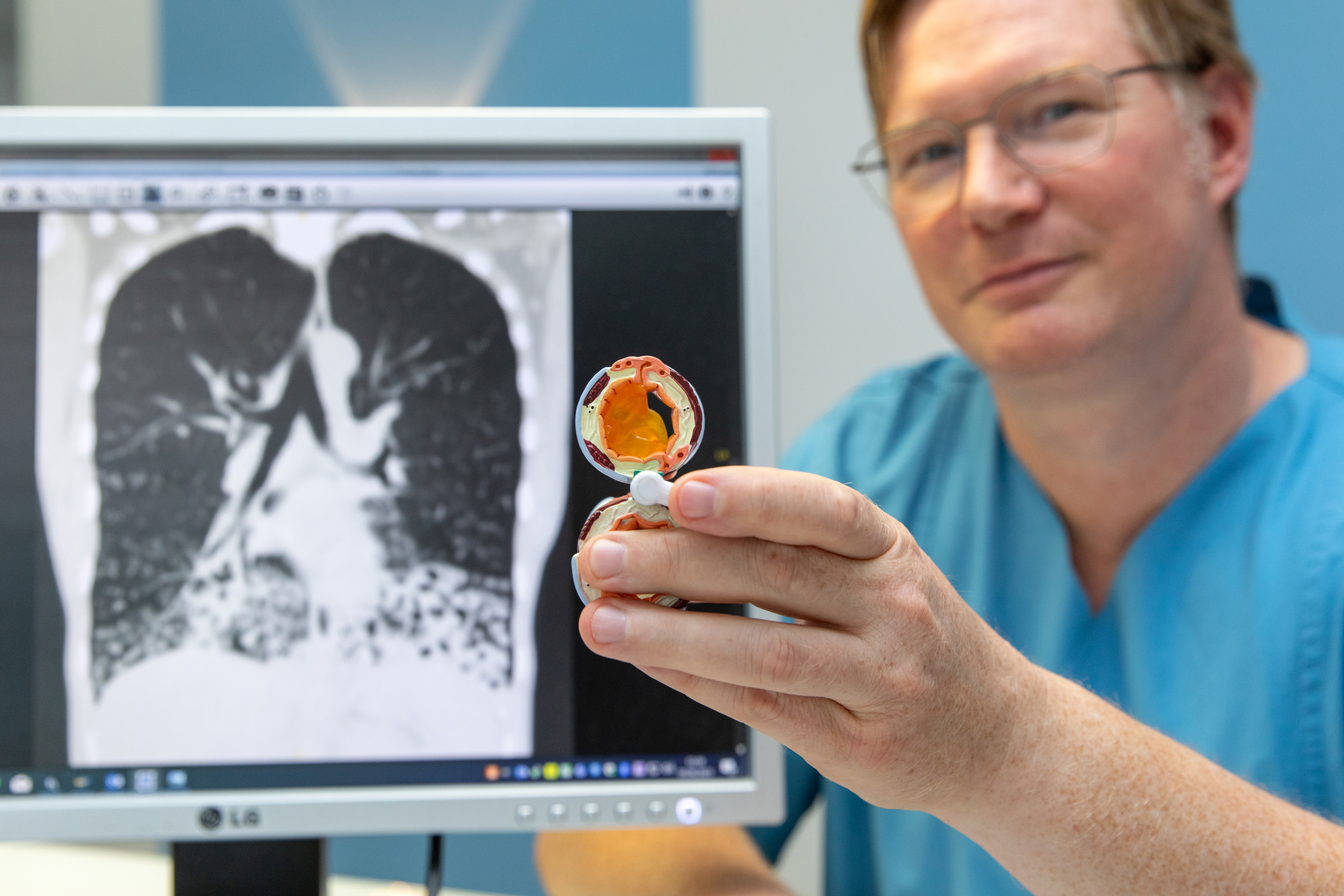 Privatdozent Dr. Felix Ringshausen sitzt vor dem Röntgenbild der Lunge einer PCD-Betroffenen und zeigt ein Modell eines durch Schleim verstopften Atemweges.