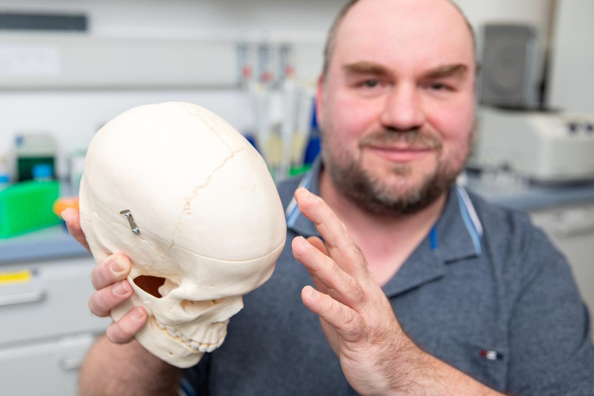 Prof. Dr. Christoph Garbers hält das Modell eines menschlichen Schädels in der Hand. . 