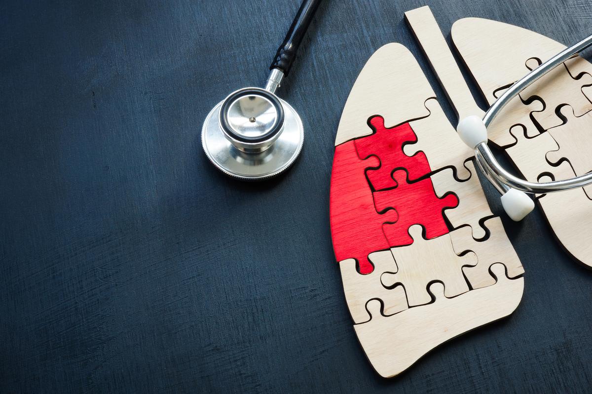 A stethoscope lies next to a lung-shaped puzzle made of light and red puzzle pieces.
