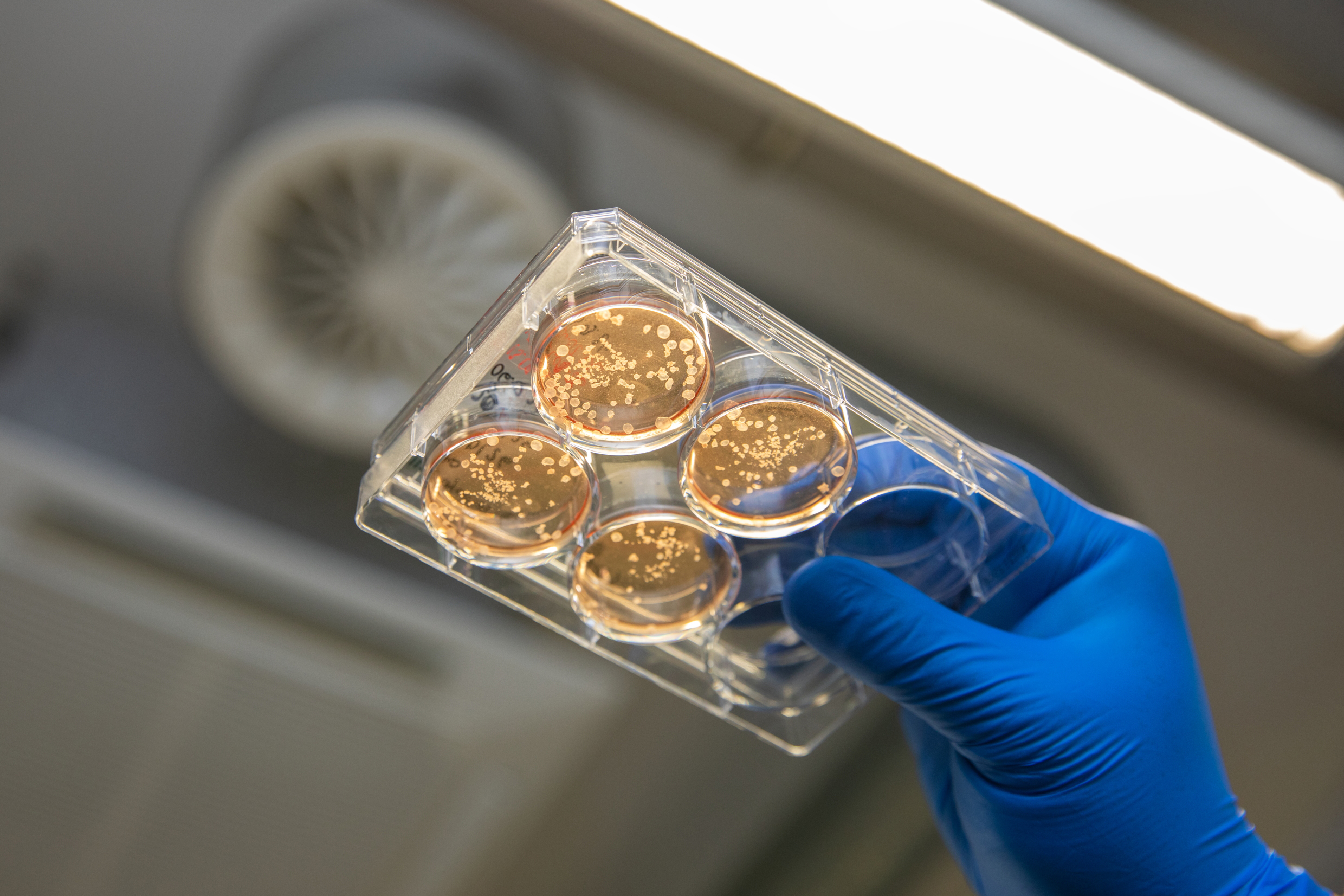 Eine Hand in blauem Handschuh hält einen druchsichtigen Behälter mit weißen Zellverbünden in der roten Nährflüssigkeit.