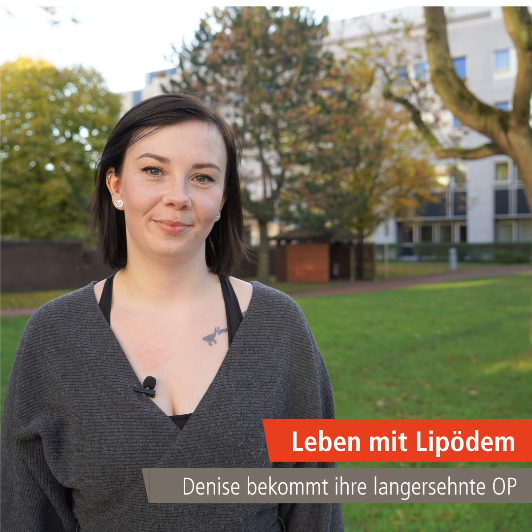 Denise Haasper, Lipödem-Patientin schaut in die Kamera