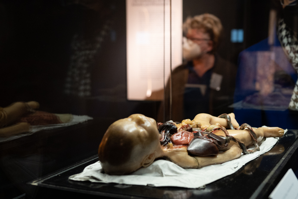 In einer Vitrine liegt das Wachsmodell eines Kindes, dessen inneren Organa freiliegen. Durch die Glasscheibe sieht man im Hintergrund eine Besucherin. 