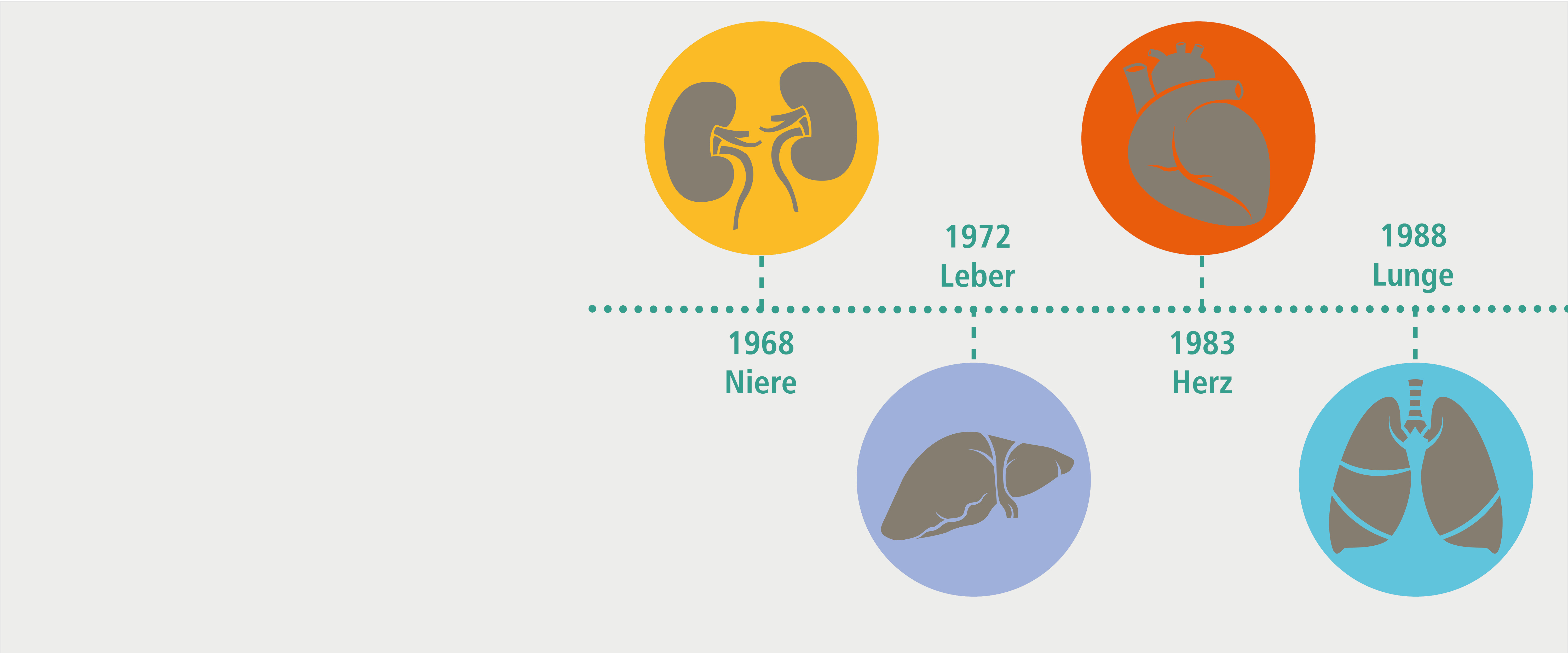 An der MHH wurde ie erste Niere 1968 transplantiert, die erste Leber 1972, das erste Herz 1983 und die erste Lunge 1988. Copyright: MHH/Transplantationszentrum