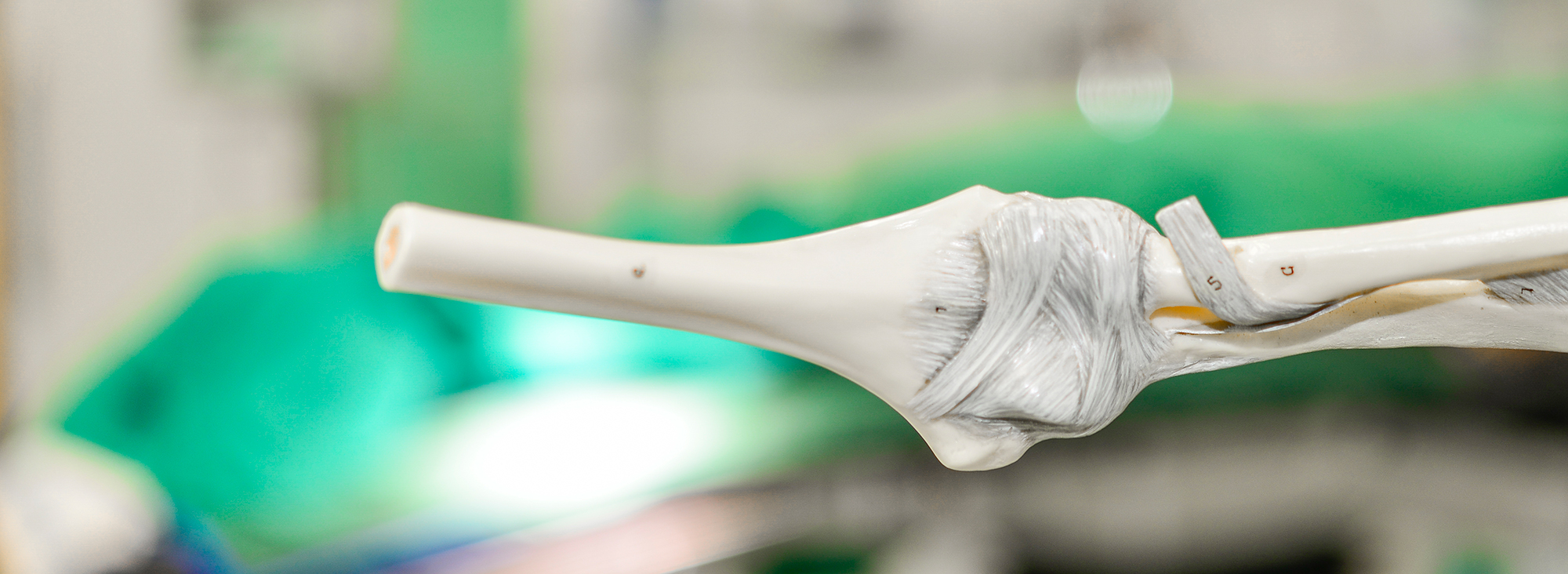 copyright: Tom Figiel/MHH Anatomisches Modell Ellenbogen