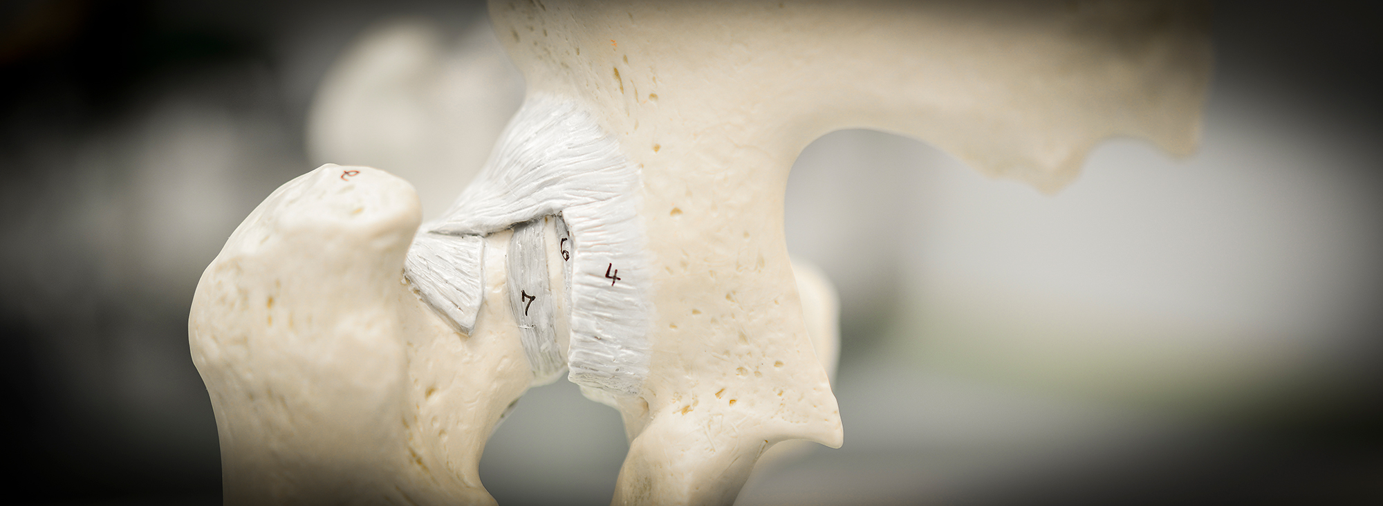 copyright: Tom Figiel/MHH Anatomisches Modell Hüftgelenk