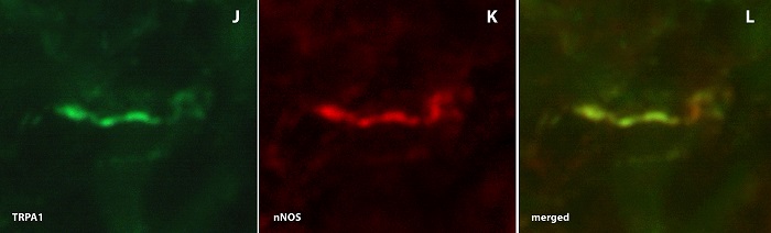 Expression von TRPA1 in einer Nervenfaser der Vaginalwand, Copyright: Klinik für Urologie/MHH