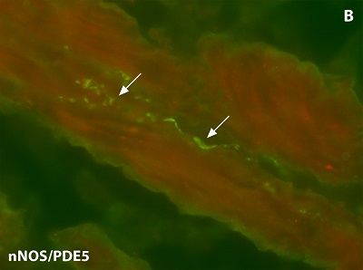 Neuronale Stickoxid-Synthase (grün) und Phosphodiesterase 5 (rot) in der Prostata, Copyright: Klinik für Urologie/MHH
