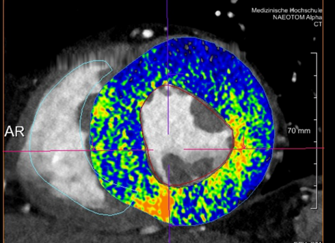 radiologisches Bild