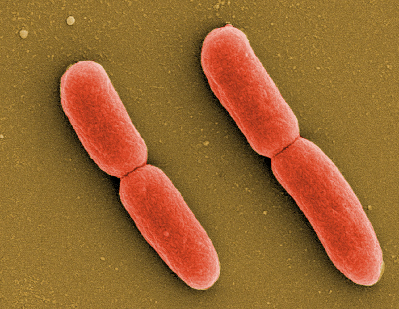 Das Bakteriums Escherichia coli. Copyright: ©HZI/Rohde