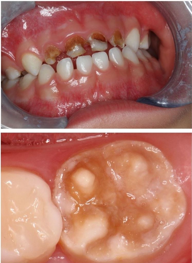 Zähne schlechte Zahnarzt Strahlemann